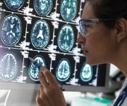 Protecting brain cells against neurodegeneration